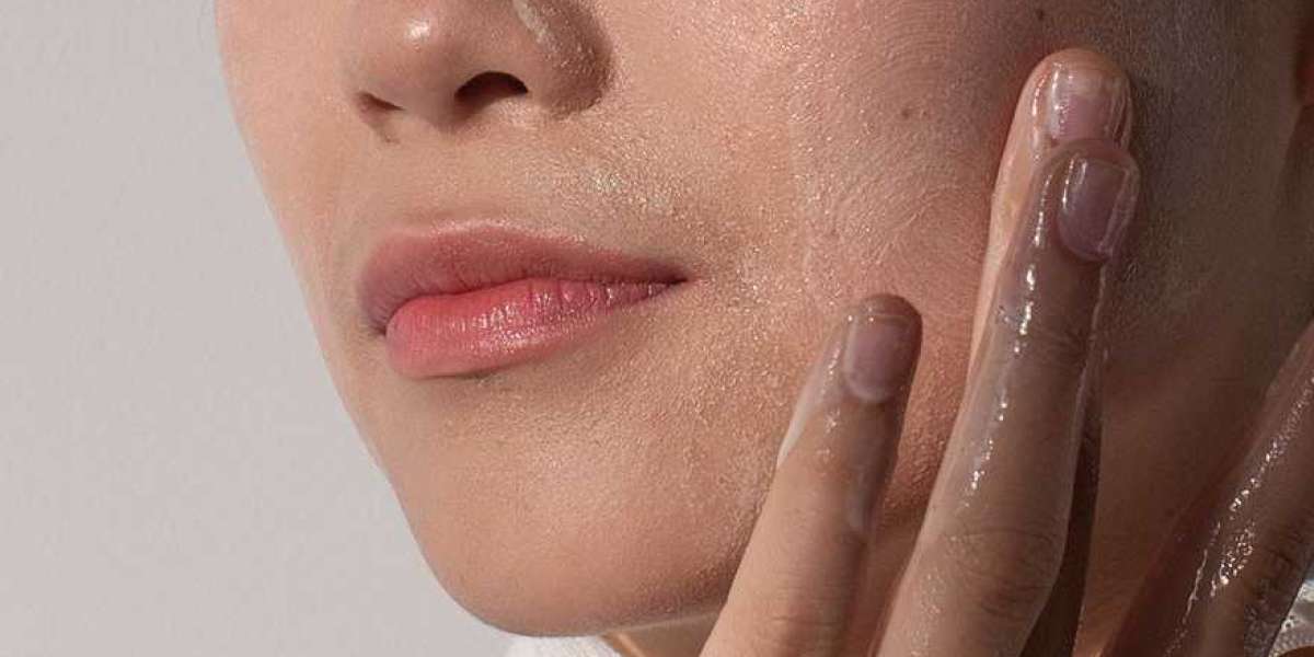 Tips for Banishing Acne and Blemishes
