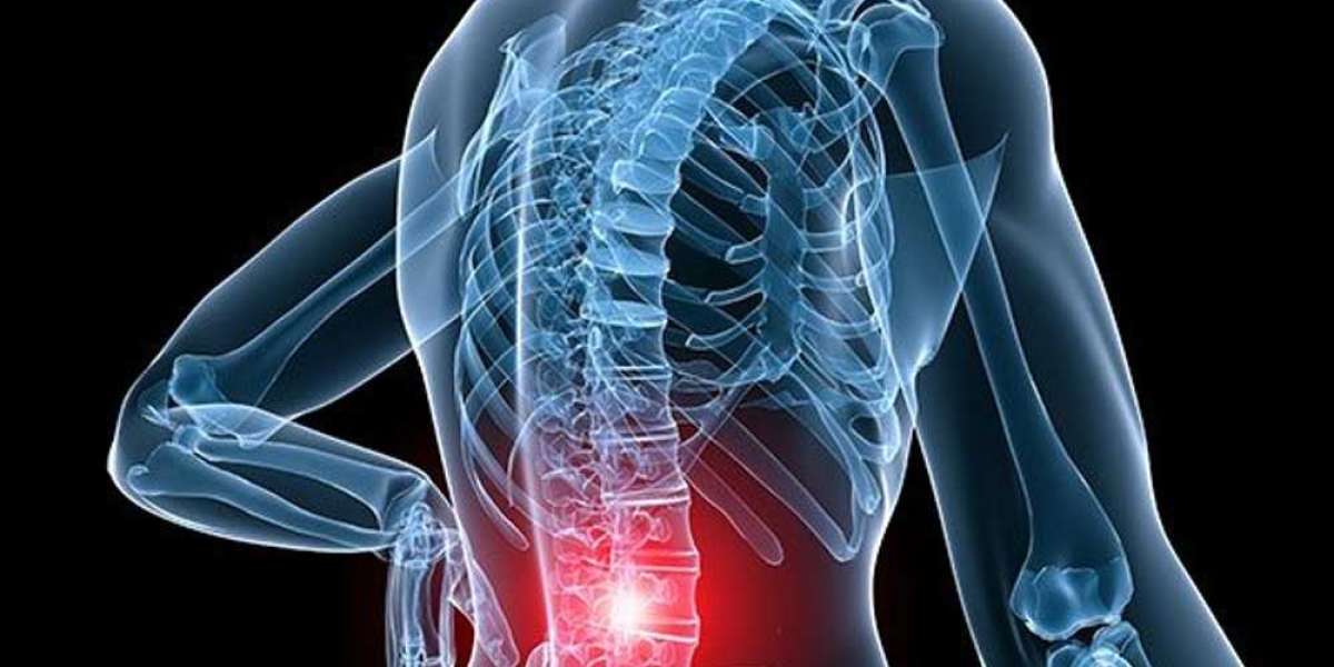 Stem Cell Therapy: A Breakthrough Treatment for Chronic Spine Pain