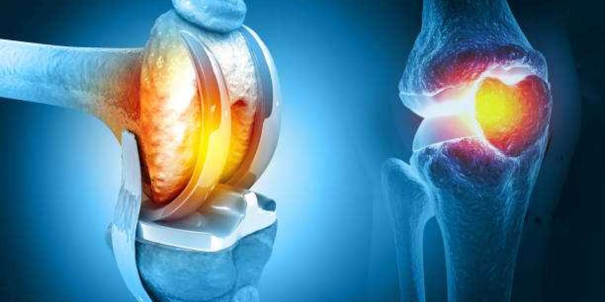 Find the Best Orthopaedic Surgeon in Nagpur at Gadge Hospital