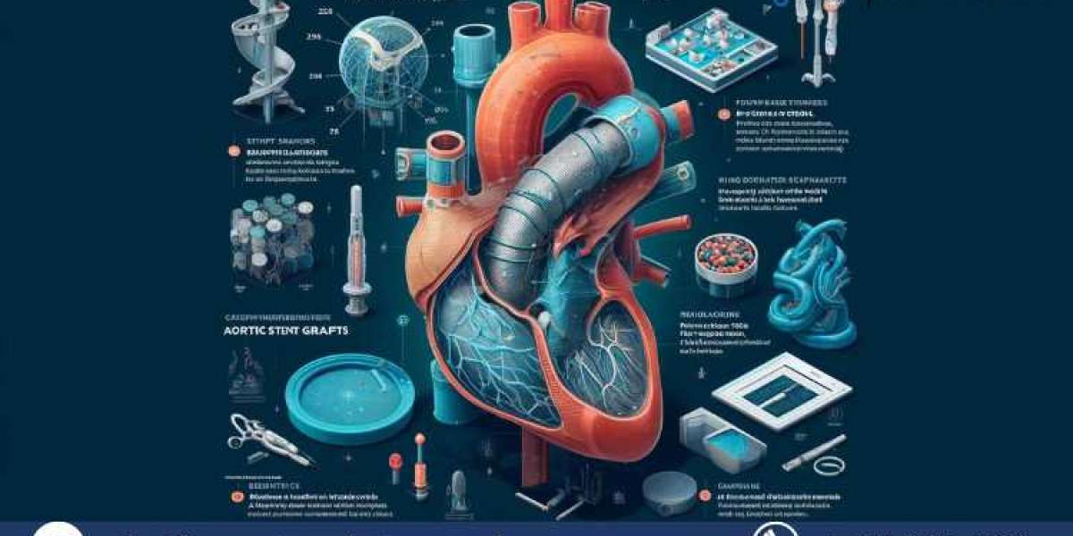 Europe Aortic Stent Graft Market: Trends, Growth, and Competitive Landscape 2032