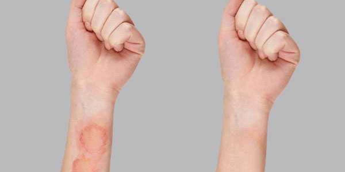 Skin Infection: Pictures, Types, Causes and Treatments