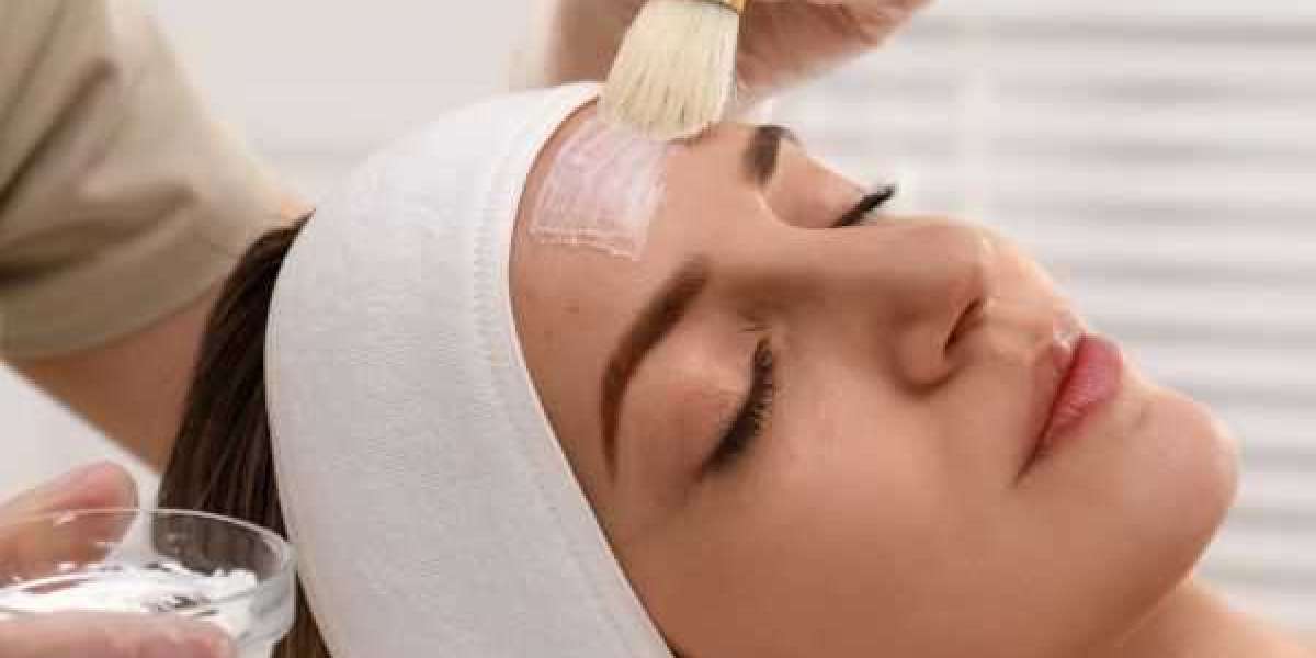 Understanding the Healing Process After a Chemical Peel